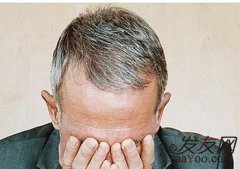 影响植发手术效果的因素都有什么？