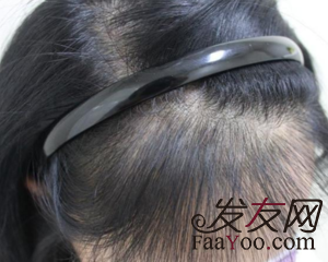 女性脱发和掉发有什么区别?