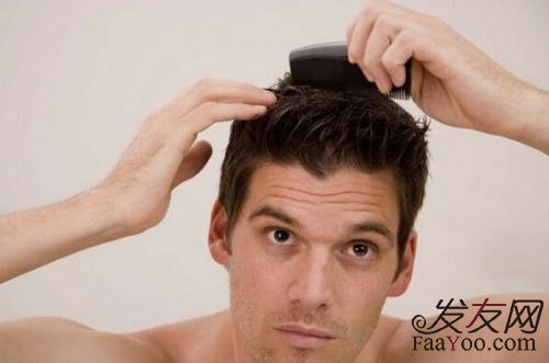 男性脱发应该注意哪几点？