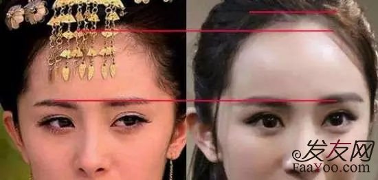 很多明星为什么不去植发?