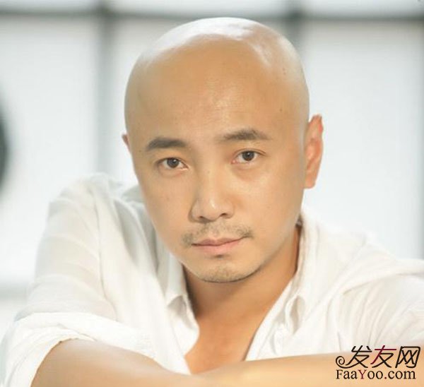 很多明星为什么不去植发?