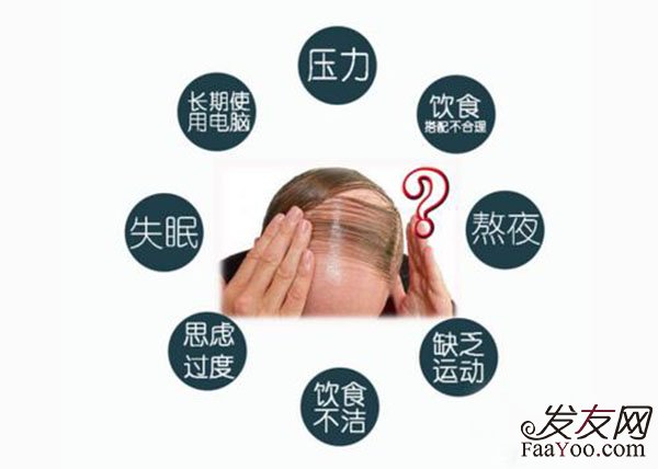 一般脱发原因和那些因素有关?