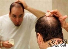植发后的头发生长情况怎么样？