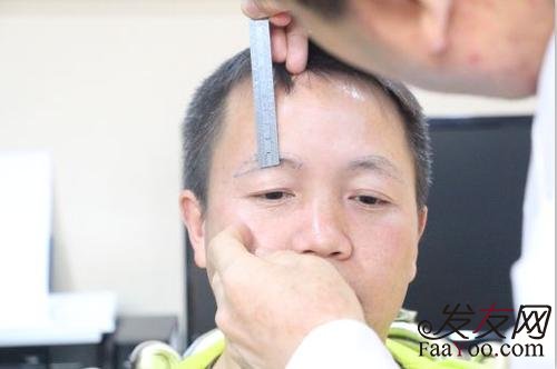为什么植发的人越来越多了?