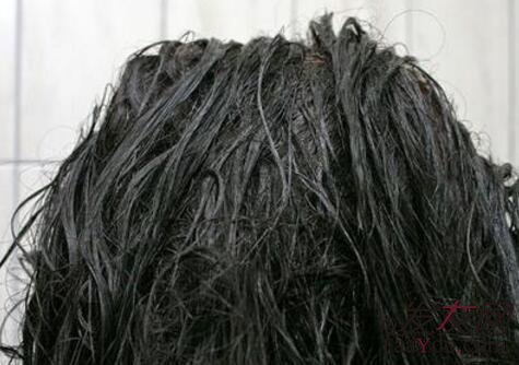 怎么看自己是不是脂溢性脱发呢?