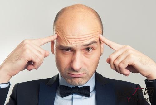 男性秃头的话可以带假发吗?