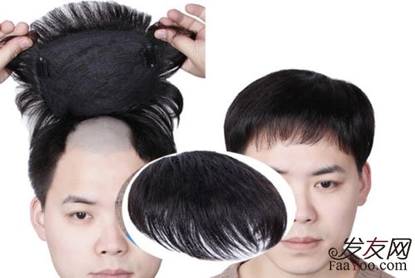 男性秃头的话可以带假发吗?