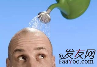 男性出现发际线上移正常吗?