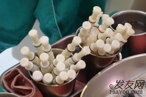 毛发移植区取发区怎么护理？