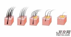 含维生素C的食物对脱发有好处吗？