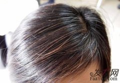 一天掉几十根头发是正常现象吗？