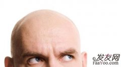 脱发和平时所用的洗发水有关吗？