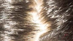 脱发的人该用哪种洗发水好呢？