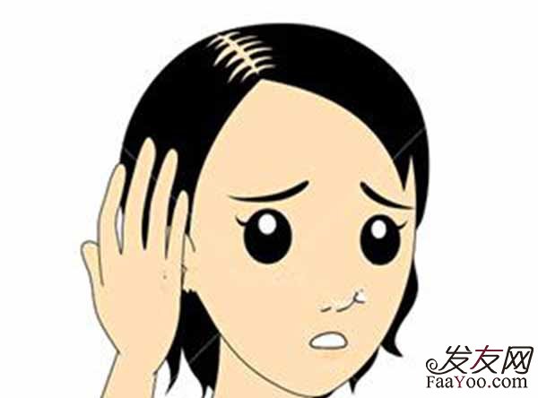 怎么做能减缓脱发程度呢?