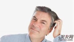 为何很多年轻人这么早就脱发了？