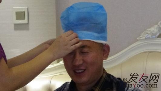 植发术后效果通常保持多久?
