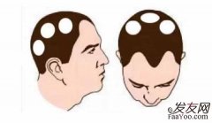 头发总是半截断掉是什么情况？