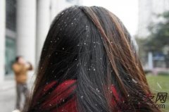 头皮屑很严重该怎么办？