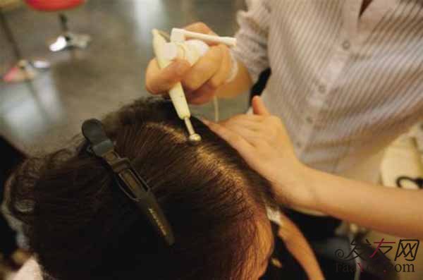 女性脱发的话会不会也变成秃顶?