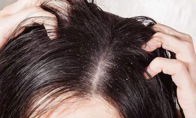 头发爱出油的原因是什么？