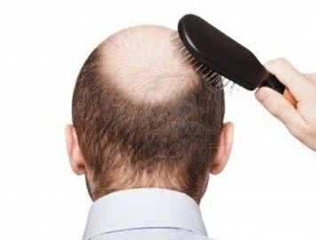 如何防止毛囊炎脱发？
