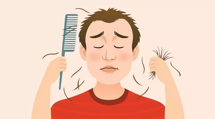 脱发的治疗