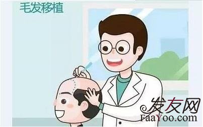 上海植发手术价格一般需要多少费用？