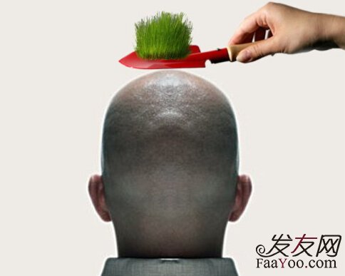 在浙江植发手术得花多少钱？