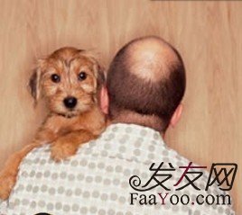 新疆植发手术靠不靠谱?收费是怎么算的?