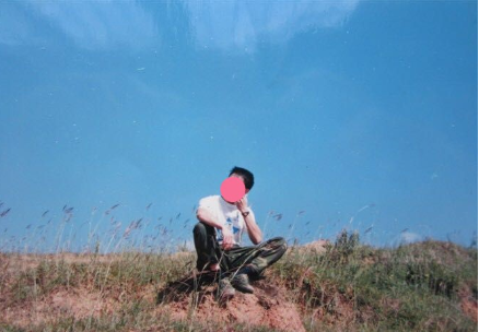 大麦微针前额发际线植发，只有行动才能决定价值