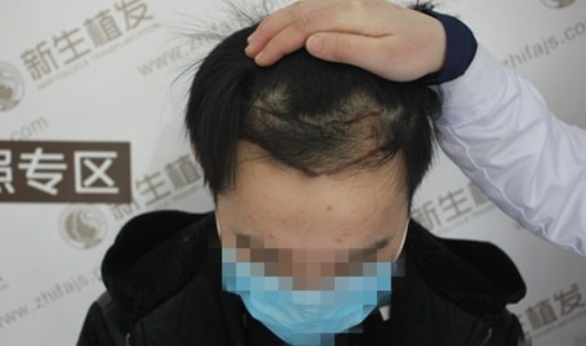 因为杭州新生植发，相亲不再被拒绝