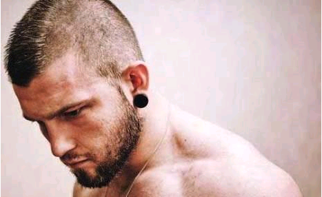 种植头发有用吗