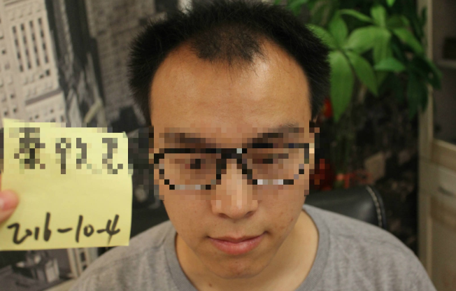 上海科发源植发2550单位！自信从头开始