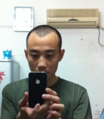 在武汉雍禾发际线额头植发手术，露脸了也无所谓