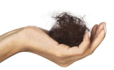 掉头发与生活习惯有关系吗？掉发严重可以植发吗？
