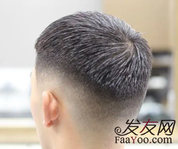 植发问题解答：毛囊移植后枕部会不会变秃？影响美观？