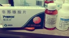脱发纠结使用药物还是植发？看完这些你就会明白！