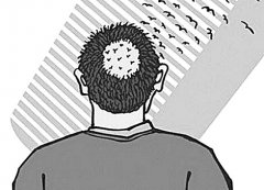 毛发种植哪里好？