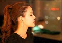 毛发种植应该考虑什么因素？