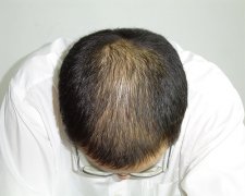头发纤维粉几天用一次？