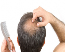 植发后遗症如何避免？