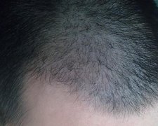 重新拥有的人生