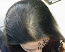 M头的烦恼为什么这么多