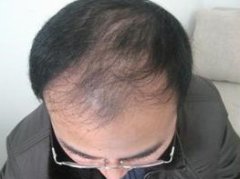 我不要再当光头强了