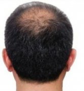 不能剃成寸头的悲哀