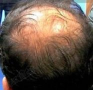 一位大叔的心理历程