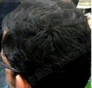 感谢苏玫氏增发纤维