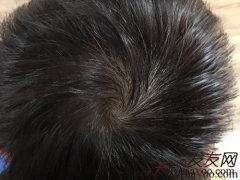 这次我志在必得