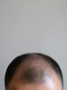 这个问题困扰了我好多年