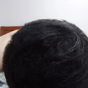 这个死穴你知道怎么解吗